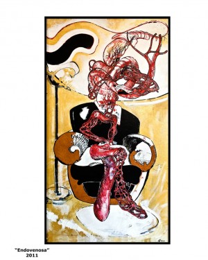 Endovenosa Endovenosa